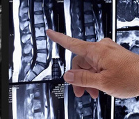 "Здоровая спина - комплексное обследование позвоночника" (МРТ шейного, грудного, пояснично-крестцового отдела позвоночни