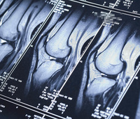 МРТ двух коленных суставов