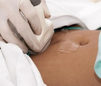 Ультразвуковая диагностика беременности (на определение беременности)